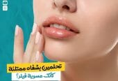 بديل الفيلر ديرموفيوتشر