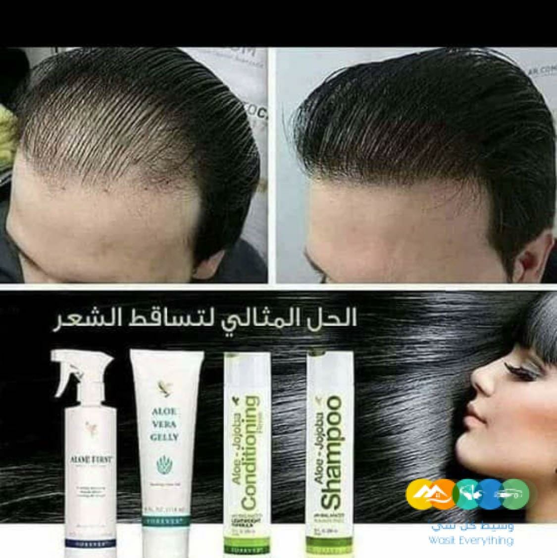 الحل المثالي لتساقط الشعر