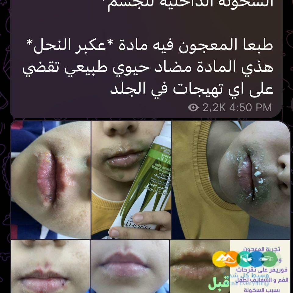 معجون اسنان١٠٠٪؜