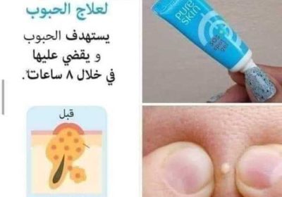 4bc8acf9-77cd-432a-98b9-4e3e4ad11667