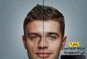 جولدن كولاجين بديل عمليات