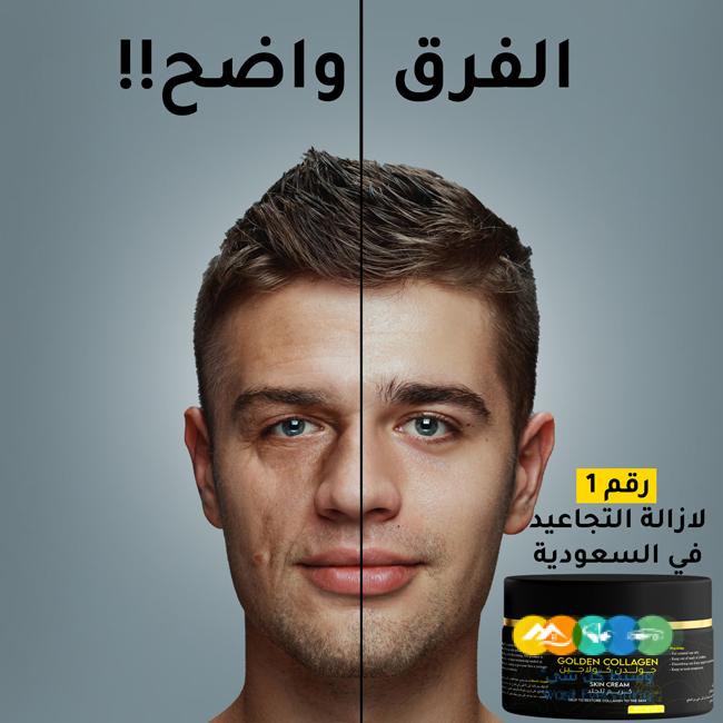 جولدن كولاجين بديل عمليات